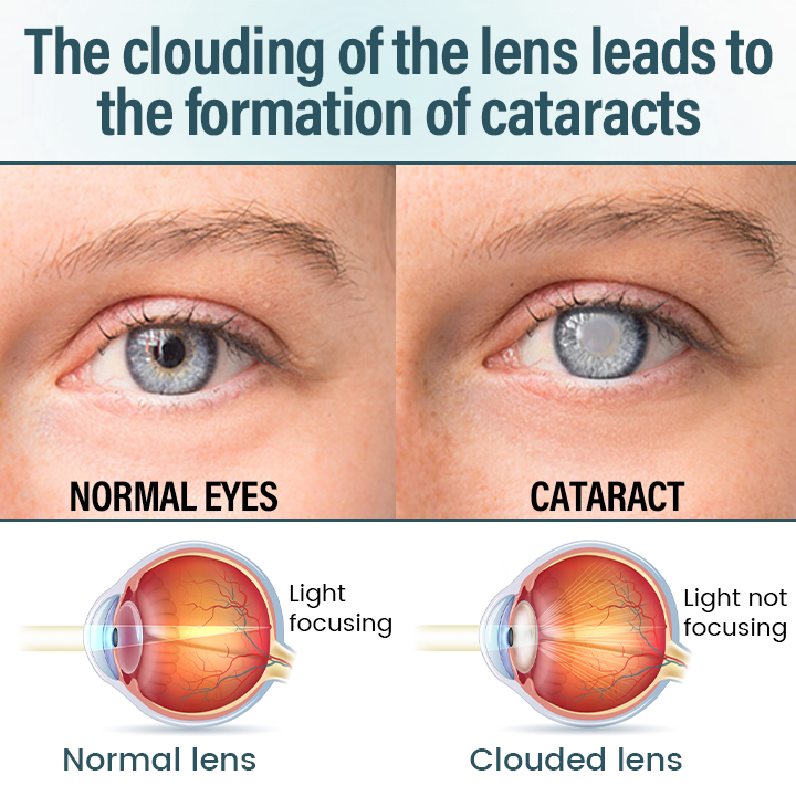 Mayo Clinic recommends👨‍⚕️: OptiFusion Nano Eye Drops Serum