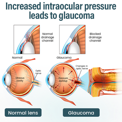 Mayo Clinic recommends👨‍⚕️: OptiFusion Nano Eye Drops Serum